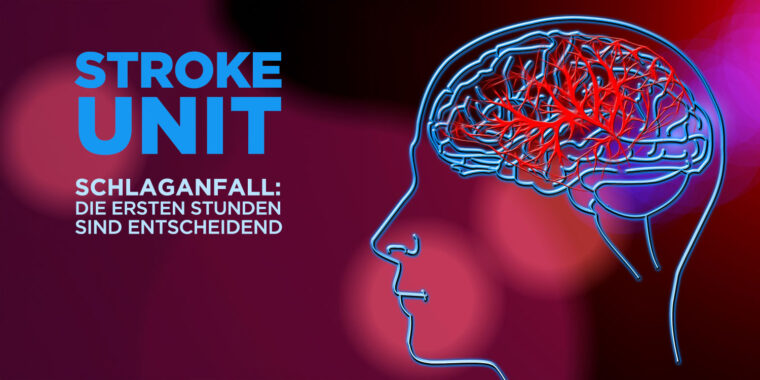 Schlaganfall-Titelbild Schlaganfall Stroke Unit
